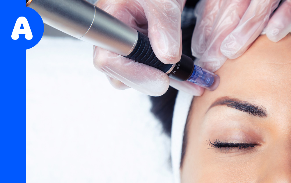 Cytopen Micro Needling Add-On | Lenoy Medical Spa NJ – LenoyMED - Elizabeth